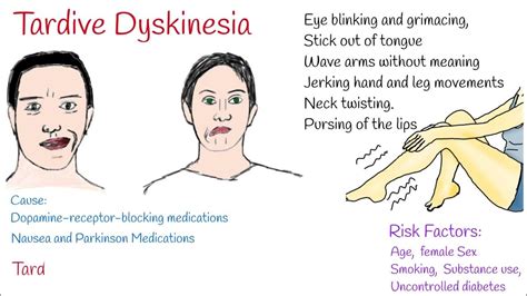 abilify lawsuit tardive dyskinesia